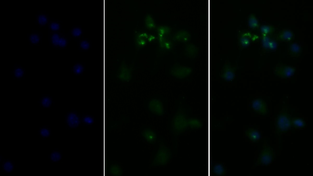 Polyclonal Antibody to Tumor Necrosis Factor Alpha (TNFa)