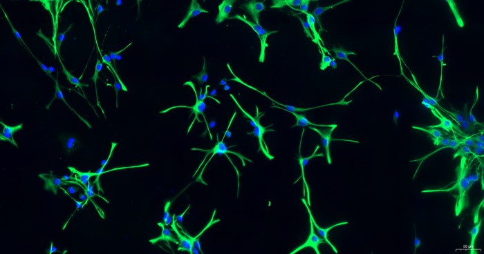 Primary Rat Brain Astrocytes (BA)