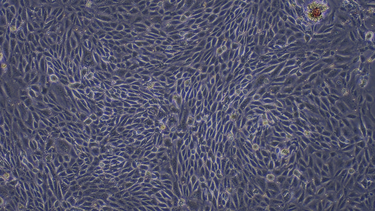 Primary Mouse Renal Tubular Epithelial Cells (RTEC)