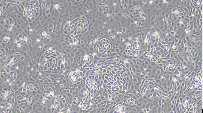 Primary Rat Renal Tubular Epithelial Cells (RTEC)