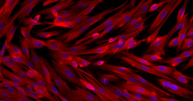 Primary Rat Bladder Stromal Fibroblasts (BSF)