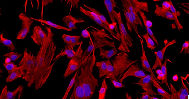 Primary Mouse Sertoli Cells (SEC)