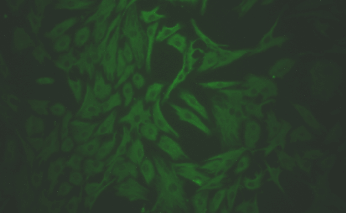 Primary Rat Gingival Fibroblasts (GF)