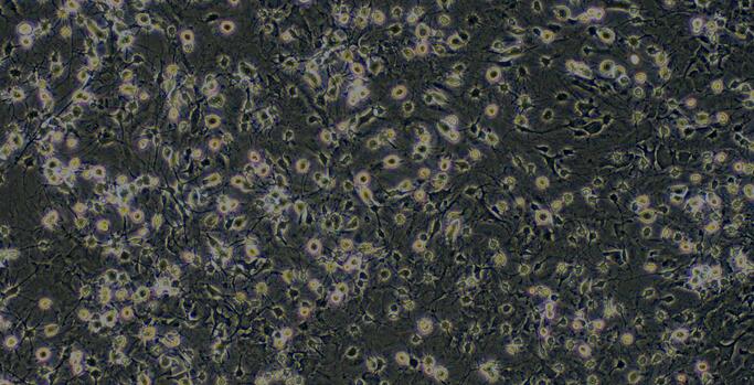 Primary Rat Spinal Cord Neuron (SCN)