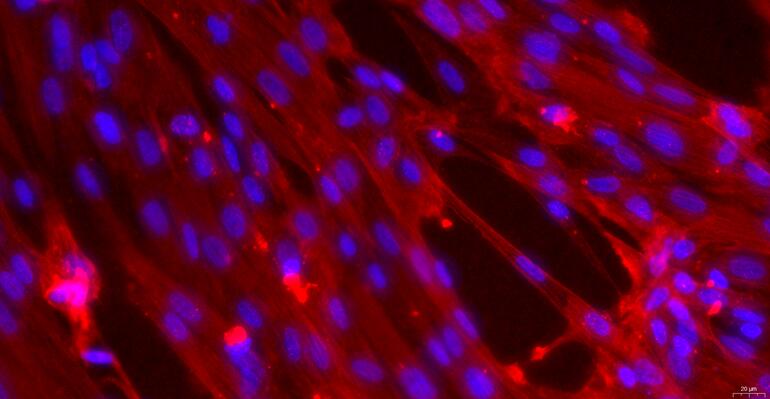 Primary Rabbit Ureter Smooth Muscle Cells (USMC