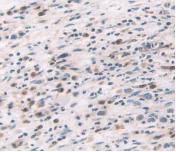 Polyclonal Antibody to Tumor Necrosis Factor Alpha (TNFa)